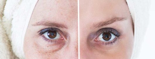 Prendre soin de son visage : les astuces et conseils
