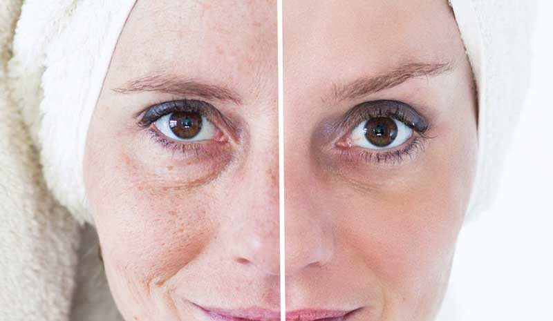 Prendre soin de son visage : les astuces et conseils